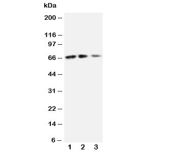 Western blot testing of CX3CL1 antibody and Lane 1: recombinant mouse protein 10ng; 2: 5ng; 3: 2.5ng~