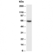 Western blot testing of GAD65 antibody and rat brain tissue lysate. Predicted molecular weight ~65 kDa.