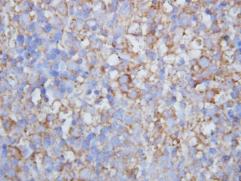 IHC-P: Lymphotactin antibody testing of mouse lymph node