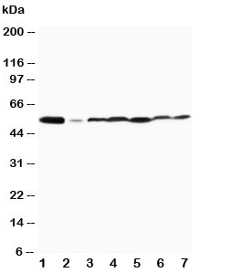 Western blot testing of MAPK8/9 antibody and Lane 1: rat brain; 2: rat thymus; 3: MCF-7; 4: HeLa; 5: Jurkat; 6: MM231; 7: CEM cell lysate