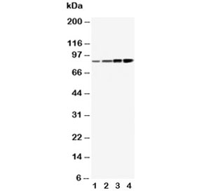 Western blot testing of PI3K antibody and Lane 1: MCF-7; 2: HeLa; 3: COLO-320; 4: SW620 cell lysate