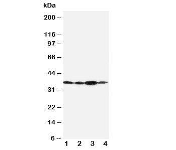 Western blot testing of Podoplanin antibody and Lane 1: SMMC-7721; 2: 293T; 3: HeLa; Predicted size: 36KD; Observed size: 36KD