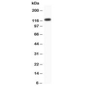 Western blot testing of Progesterone Receptor antibody and human HeLa cell lysate. Expected molecular weight: 82-94 kDa (PR-A) and 99-120 kDa (PR-B).