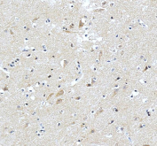 IHC staining of FFPE human brain tissue with Pleiotrophin antibody, HRP-labeled secondary and DAB substrate. HIER: boil tissue sections in pH8 EDTA for 20 min and allow to cool before testing.