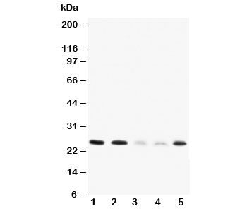 Western blot testing of Pleiotrophin antibody and Lane 1: rat brain; 2: rat kidney; 3: MCF-7; 4: HT1080; 5: SMMC-7721 cell lysate~