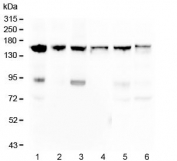 Western blot testing of human 1) HeLa, 2) 22RV1, 3) U-87 MG, 4) ThP-1, 5) PC-3 and 6) Caco-2 cell lysate with Thrombospondin 2 antibody. Expected molecular weight: 130-170 kDa depending on glycosylation level.