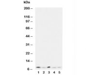 Western blot testing of Ubiquitin antibody and Lane 1:  rat thymus;  2: human MCF-7;  3: MM231;  4: HeLa;  5: SMMC-7721 cell lysate.