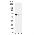 Western blot testing of Fetuin-A antibody and Lane 1:  recombinant human protein 10ng;  2: 5ng;  3: 2.5ng