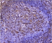 IHC staining of FFPE human tonsil with Galectin antibody. HIER: boil tissue sections in pH8 EDTA for 20 min and allow to cool before testing.