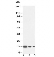 Western blot testing of IL4 antibody and Lane 1:  recombinant human protein 10ng;  2: 5ng;  3: 2.5ng. Expected molecular weight: 14-20 kDa depending on glycosylation level.
