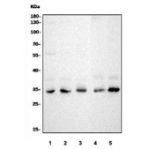 Western blot testing of 1) human HeLa, 2) human K562, 3) rat PC-12, 4) mouse NIH 3T3 and 5) mouse RAW264.7 cell lysate with Cdk4 antibody. Predicted molecular weight ~34 kDa.