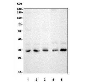 Western blot testing of 1) human HeLa, 2) human K562, 3) rat PC-12, 4) mouse NIH 3T3 and 5) mouse RAW264.7 cell lysate with Cdk4 antibody. Predicted molecular weight ~34 kDa.