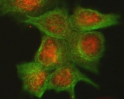Immunofluorescent staining of FFPE human MCF7 cells with Cdk4 antibody (red) and Alpha Tubulin mAb (green). HIER: steam section in pH6 citrate buffer for 20 min.