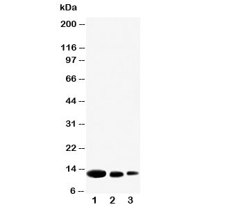 Western blot testing of CXCL9 antibody and Lane 1: recombinant human protein 10ng; 2: 5ng; 3: 2.5ng~