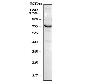 Western blot testing of OPN antibody and Lane 1: MM231; 2: HeLa; 3: Jurkat; 4: COLO320 cell lysate. The glycoprotein is visualized between 44~75.KD~