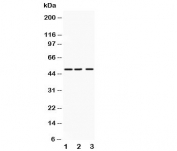 Western blot testing of ANGPTL4 antibody and Lane 1:  human placenta;  2: SMMC-7721;  3: HeLa lysate.  Expected molecular weight: 50-55 kDa.