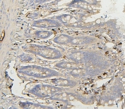 IHC staining of FFPE rat intestine with BAK antibody. HIER: boil tissue sections in pH8 EDTA for 20 min and allow to cool before testing.