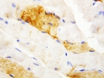 IHC-P: Carbonic Anhydrase III antibody testing of rat skeletal muscle tissue. HIER: steam section in pH6 citrate buffer for 20 min.