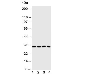Western blot testing of Carbonic Anhydrase III antibody and Lane 1: SMMC-7721; 2: HeLa; 3: SW620; 4: SCG cell lysate~