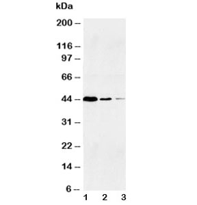 Western blot testing of Caspase-1 antibody and Lane 1: Jurkat; 2: Raji; 3: CEM~