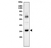 Western blot testing of human Jurkat cell lysate with Caspase-6 antibody. Predicted molecular weight: ~33 kDa (precursor).