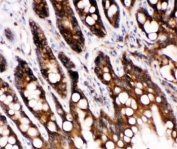 IHC-P: Caspase-6 antibody testing of rat intestine tissue