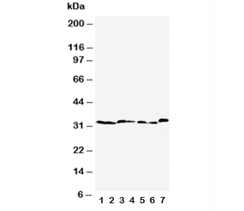 Western blot testing of Caspase-6 antibody and Lane 1: rat liver; 2: rat kidney; 3: rat testis; 4: NRK; 5: mouse liver; 6: mouse kidney; 7: mouse testis tissue lysate