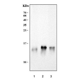 Western blot testing of 1) human HCCT, 2) rat liver and 3) mouse liver tissue ly