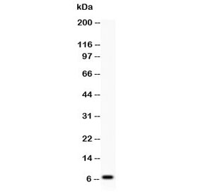 Western blot testing of Defensin 1 antibody at and COLO320 lysate; Predicted size: 7KD; Observed size: 7KD~