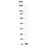 Western blot testing of Defensin 1 antibody and human COLO320 lysate;  Predicted molecular weight ~7 kDa.