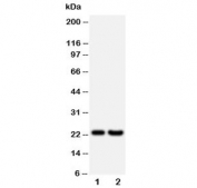 Western blot testing of FGF9 antibody and Lane 1:  rat brain;  2: human HeLa lysate;  Predicted molecular weight ~23 kDa with a possible 45-55 kDa dimer.