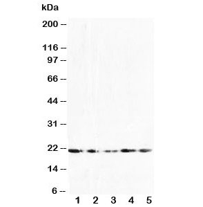 Western blot testing of FGF10 antibody and Lane 1: U87; 2: HeLa; 3: A549; 4: 293T; 5: HeLa cell lysate