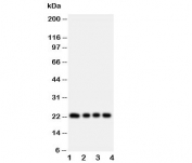 Western blot testing of FGF22 antibody and rat samples:  1. ovary;  2. ovary;  3. testis;  4. testis tissue lysate