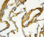 IHC-P: Surfactant protein A antibody testing of rat lung tissue. HIER: steamed with pH6 citrate buffer.