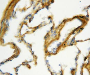 IHC-P: Surfactant protein A antibody testing of rat lung tissue