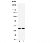 Western blot testing of Surfactant protein A antibody and Lane 1:  mouse lung;  2: rat lung tissue lysate. Predicted molecular weight: ~26 kDa but may be observed at higher molecular weights due to glycosylation.