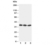 Western blot testing of DKK1 antibody and Lane 1:  U87;  2: MCF-7;  3: A549 cell lysate. Predicted molecular weight: 26-40 kDa depending on glycosylation level.