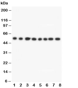 Western blot testing of Lipoamide Dehydrogenase antibody and Lane 1: rat liver; 2: rat brain; 3: rat ovary; 4: rat testis; 5: SMMC-7721; 6: HeLa; 7: SMMC-7721; 8: Jurkat cell lysate
