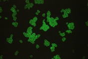 Immunofluorescent staining of FFPE human HCT116 cells with Lipoamide Dehydrogenase antibody. HIER: steam section in pH6 citrate buffer for 20 min.