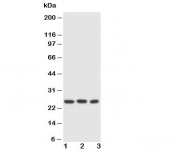 Western blot testing of FADD antibody and Lane 1:  HeLa;  2: SMMC-7721;  3: SW620 cell lysate