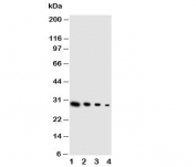 Western blot testing of GDNF antibody and Lane 1:  recombinant human protein 10ng;  2: 5ng;  3: 2.5ng;  4: 1.25ng