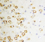 IHC staining of FFPE rat brain with GDNF antibody. HIER: boil tissue sections in pH6, 10mM citrate buffer, for 20 min and allow to cool before testing.