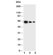 Western blot testing of IL-23 antibody and Lane 1:  recombinant mouse protein 10ng;  2: 5ng;  3: 2.5ng (p40 + p19)
