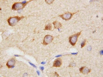IHC staining of FFPE rat brain tissue with PPID antibody. HIER: boil tissue sections in pH8 EDTA for 20 min and allow to cool before testing.~