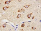 IHC staining of FFPE rat brain tissue with PPID antibody. HIER: boil tissue sections in pH8 EDTA for 20 min and allow to cool before testing.