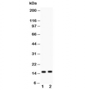Western blot testing of FABP5 antibody and Lane 1) human HeLa and 2) HEPG2 lysate;  Predicted molecular weight ~15 kDa.