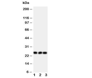 Western blot testing of FGF19 antibody and Lane 1: rat brain; 2: human U87; 3: human SMMC-7721 lysate. Predicted molecular weight ~24 kDa.~