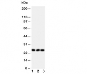 Western blot testing of FGF19 antibody and Lane 1:  rat brain;  2: human U87;  3: human SMMC-7721 cell lysate. Predicted molecular weight ~24 kDa.