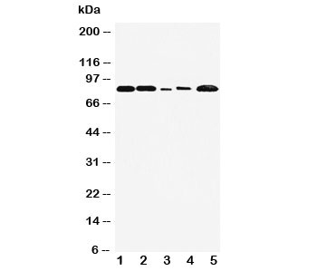 Western blot testing of FGFR1 antibody and Lane 1: rat liver; 2: rat brain; 3: SMMC-7721; 4: HT1080; 5: MM231 cell lysate. Predicted molecular weight: 75-160 kDa depending on glycosylation level