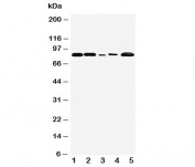 Western blot testing of FGFR1 antibody and Lane 1:  rat liver;  2: rat brain;  3: SMMC-7721;  4: HT1080;  5: MM231 cell lysate. Predicted molecular weight: 75-160 kDa depending on glycosylation level.